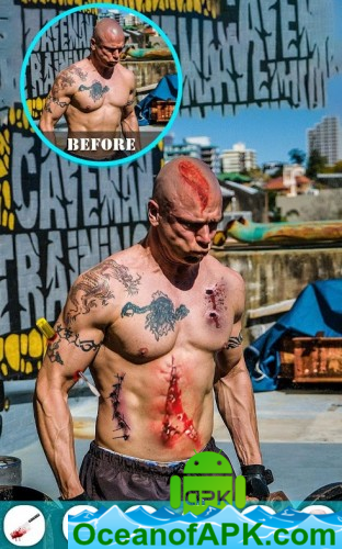 Injury Photo Editor v1.4 [PREMIUM] APK Free Download